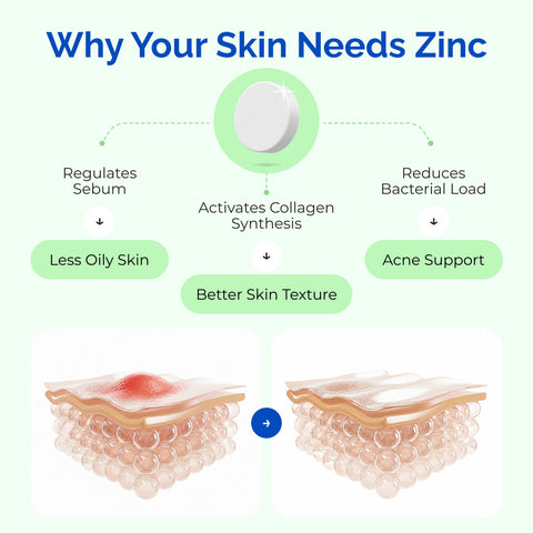 Nuzinc